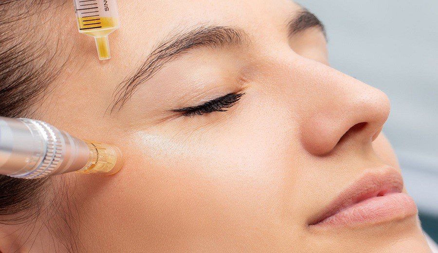 پی آر پی چه مزیتی دارد