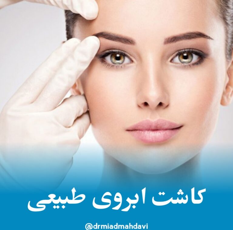 Eyebrow transplantation