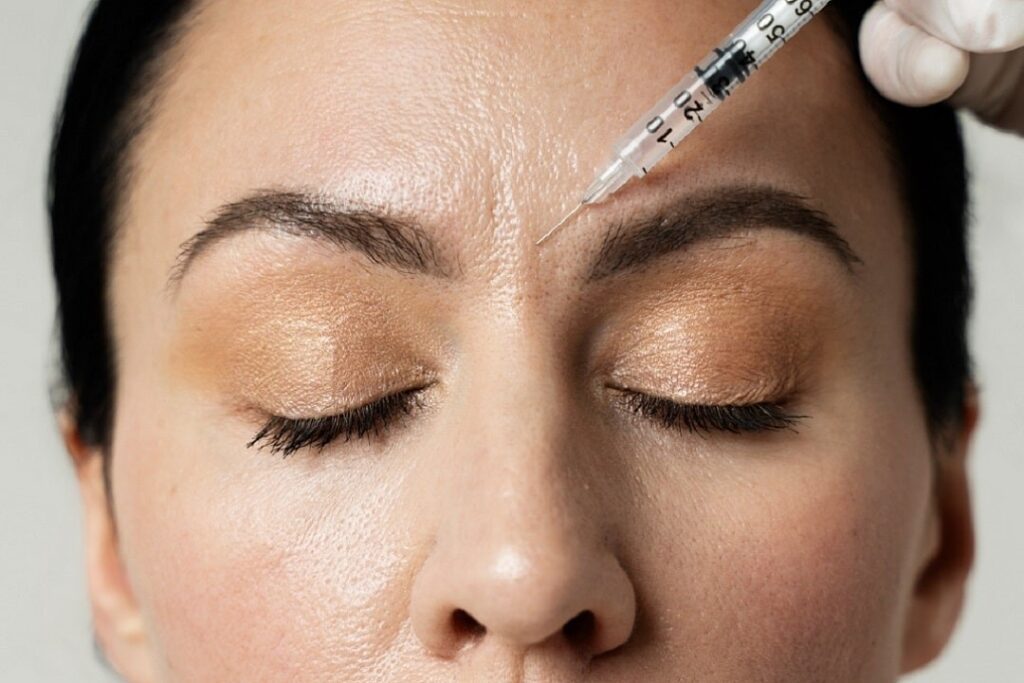 ازبین بردن خط اخم با بوتاکس