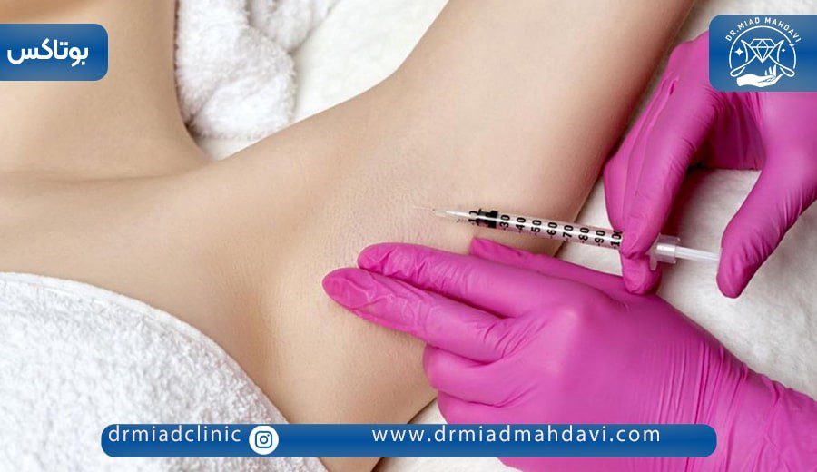 بوتاکس زیر بغل | کلینیک زیبایی دکتر میعاد مهدوی