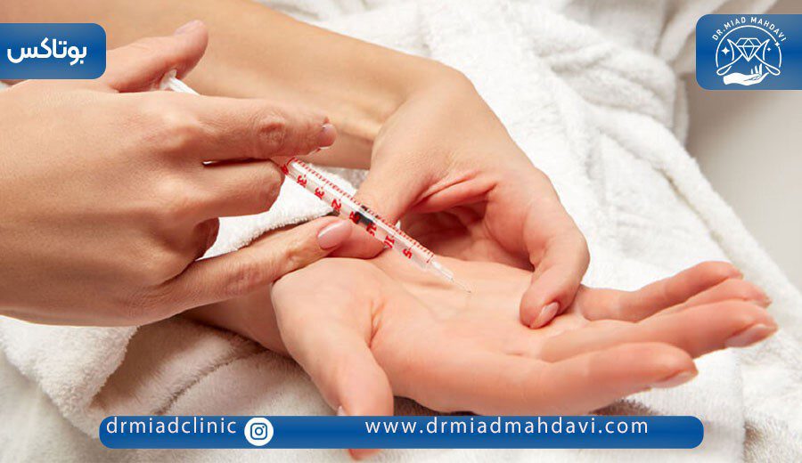 بوتاکس کف دست