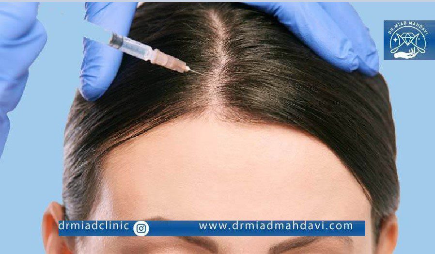 ماندگاری مزوتراپی مو