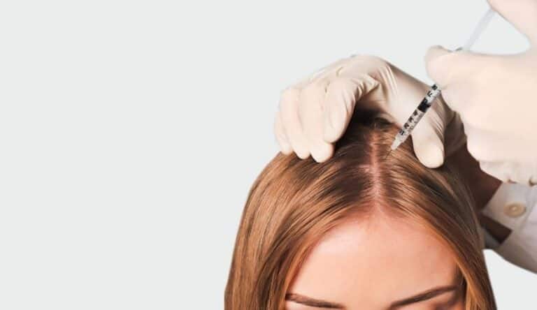 مزوتراپی مو |دکتر مزوتراپی تهران