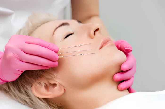 انتخاب بهترین دکتر لیفت صورت با نخ تهران دکتر میعاد مهدوی با بیشترین رضایت زیباجو