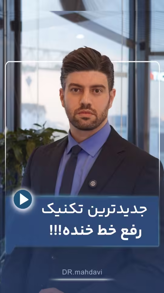 جدیدترین تکنیک رفع خط خنده