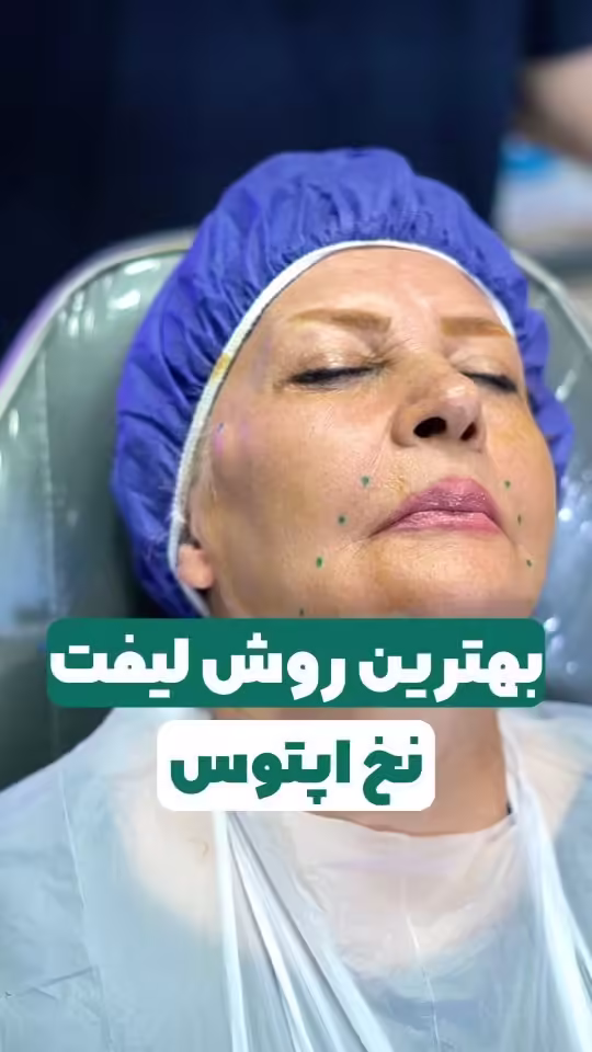 صفحه اصلی جدید 19 راز ۵ سال جوانی مستمر؛ لیفت با نخ آپتوس