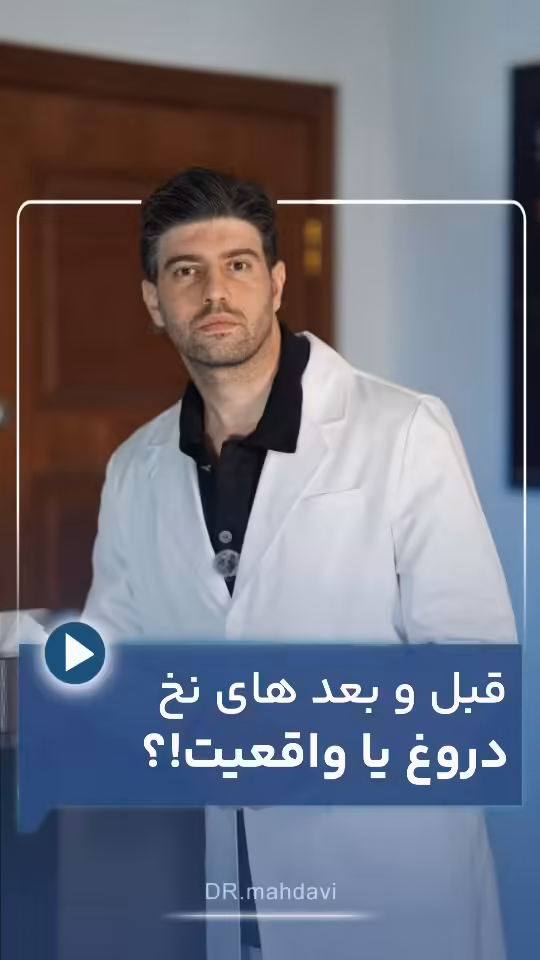 لیفت با نخ؛ واقعیت یا فریب تبلیغاتی؟ آنچه عکس‌های قبل و بعد به شما نمی‌گویند | کلینیک زیبایی لیفت صورت دکتر مهدوی