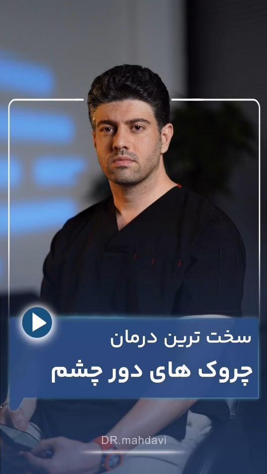 سخت‌ترین درمان چروک‌های دور چشم